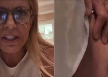 Cecilia Bolocco muestra la lesión que sufrió tras accidente doméstico