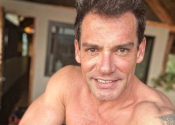 Cristián de La Fuente preocupa a sus seguidores por aspecto de su rostro