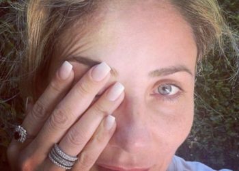 Debió asistir de urgencia a un centro médico