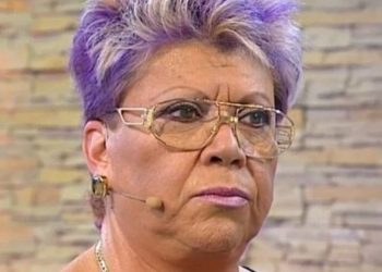 Mostró cómo quedó su rostro