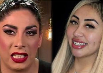 sufrió por Botota Fox