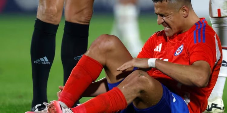 Revelan nueva lesión de Alexis Sánchez que lo traería a las canchas recién en 2025