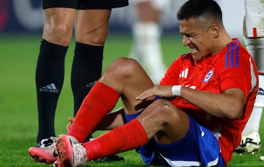 Revelan nueva lesión de Alexis Sánchez que lo traería a las canchas recién en 2025