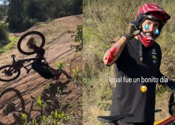 Edo Caroe sufre violenta caída que lo dejó con graves heridas