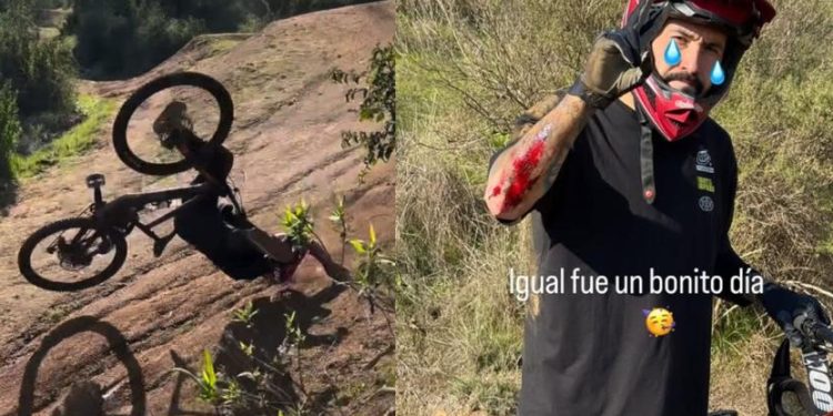 Edo Caroe sufre violenta caída que lo dejó con graves heridas