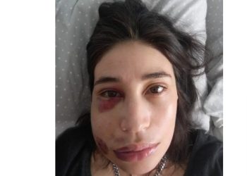 “No hay vuelta atrás”: María Paz Grandjean celebra fallo que ratifica responsabilidad de carabinero por disparo en el Estallido Social