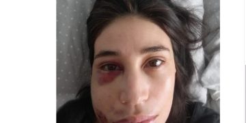 “No hay vuelta atrás”: María Paz Grandjean celebra fallo que ratifica responsabilidad de carabinero por disparo en el Estallido Social