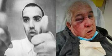 Conserje Brutalmente Agredido en Vitacura: Hijo Revela que la Golpiza No Fue “Por un Cigarro”, Desnudando Otra Cara del Caso De Los Santos