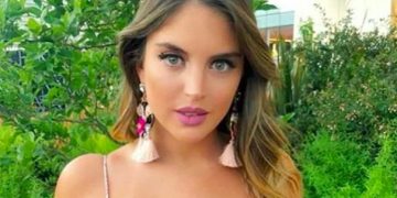 Constanza Piccoli revela cáncer de piel y lanza crudo mensaje: “esto es lo que pasa cuando no te cuidas”