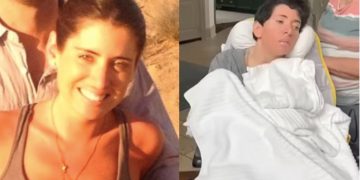 dano nueologico en mujer tras dar a luz