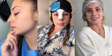 skarleth labra muestra el resultado de su operacion